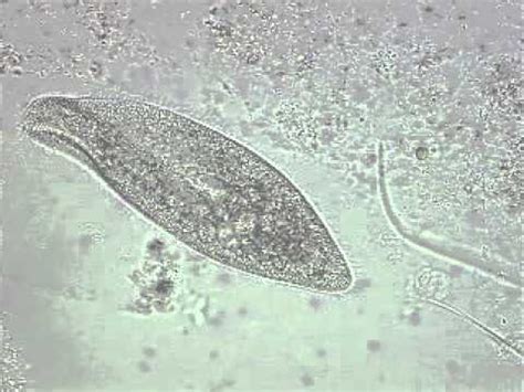  Paramecium: Un piccolo gigante dell'acqua dolce che si muove con grazia e divoratura!