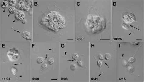 Zoosporangium! A Single-Celled Masterpiece Exhibiting Remarkable Motility and Feeding Mechanisms